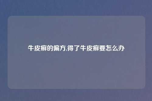 牛皮癣的偏方,得了牛皮癣要怎么办