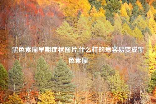 黑色素瘤早期症状图片,什么样的痣容易变成黑色素瘤