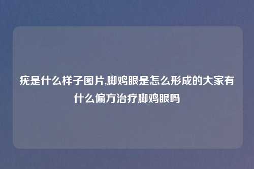 疣是什么样子图片,脚鸡眼是怎么形成的大家有什么偏方治疗脚鸡眼吗