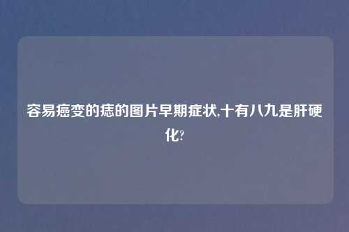 容易癌变的痣的图片早期症状,十有八九是肝硬化?