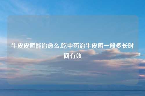 牛皮皮癣能治愈么,吃中药治牛皮癣一般多长时间有效