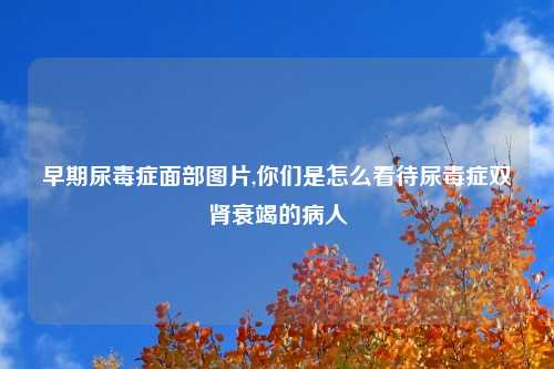 早期尿毒症面部图片,你们是怎么看待尿毒症双肾衰竭的病人