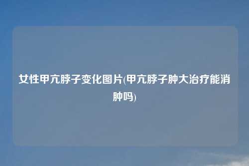 女性甲亢脖子变化图片(甲亢脖子肿大治疗能消肿吗)