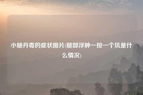 小腿丹毒的症状图片(腿部浮肿一按一个坑是什么情况)