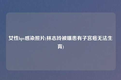 女性hpv感染照片(林志玲被曝患有子宫癌无法生育)