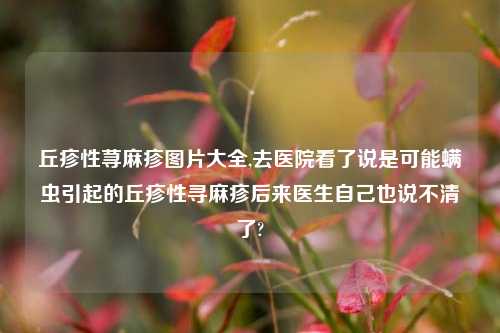 丘疹性荨麻疹图片大全,去医院看了说是可能螨虫引起的丘疹性寻麻疹后来医生自己也说不清了?