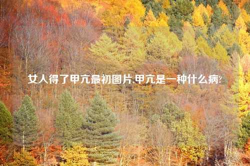 女人得了甲亢最初图片,甲亢是一种什么病?